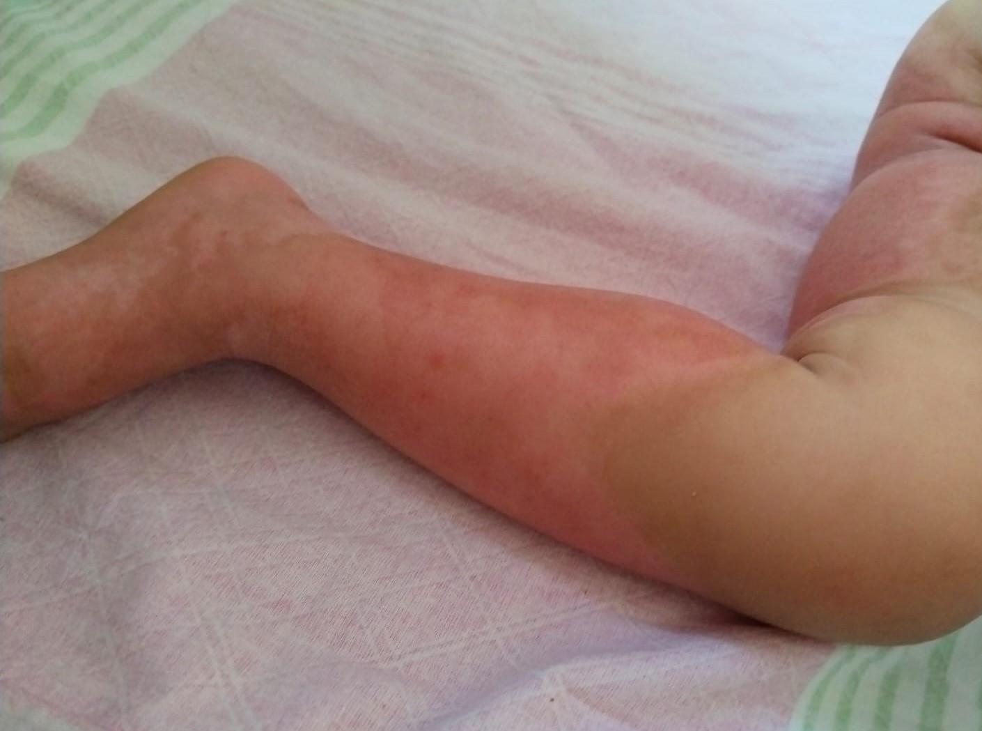 Жыныстық микрофильмдер